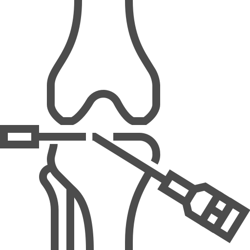 Arthroscopy