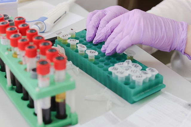 lab test